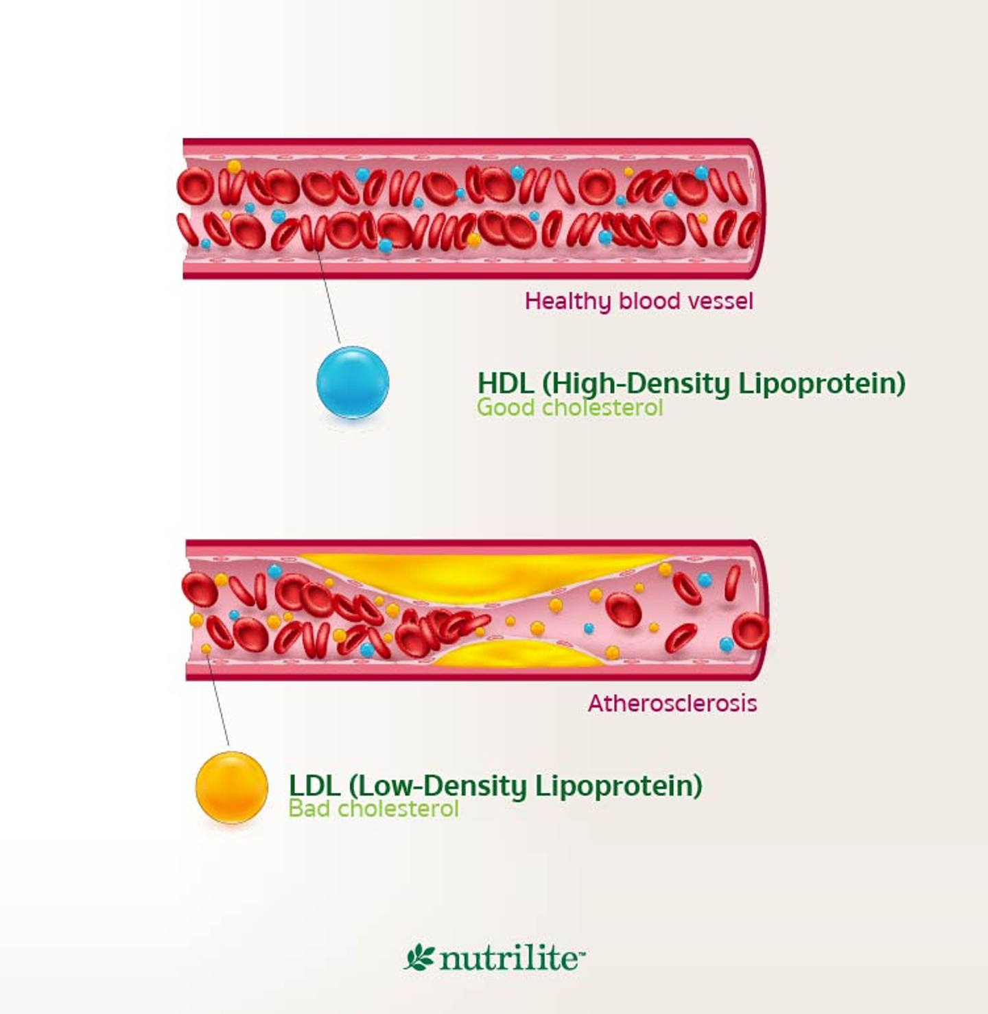 ไขมันในเส้นเลือดคืออะไร? แบ่งเป็นกี่ประเภท