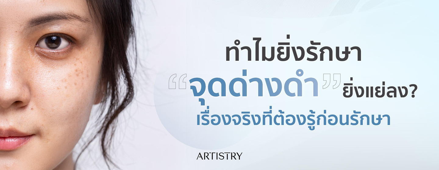 จุดด่างดำ