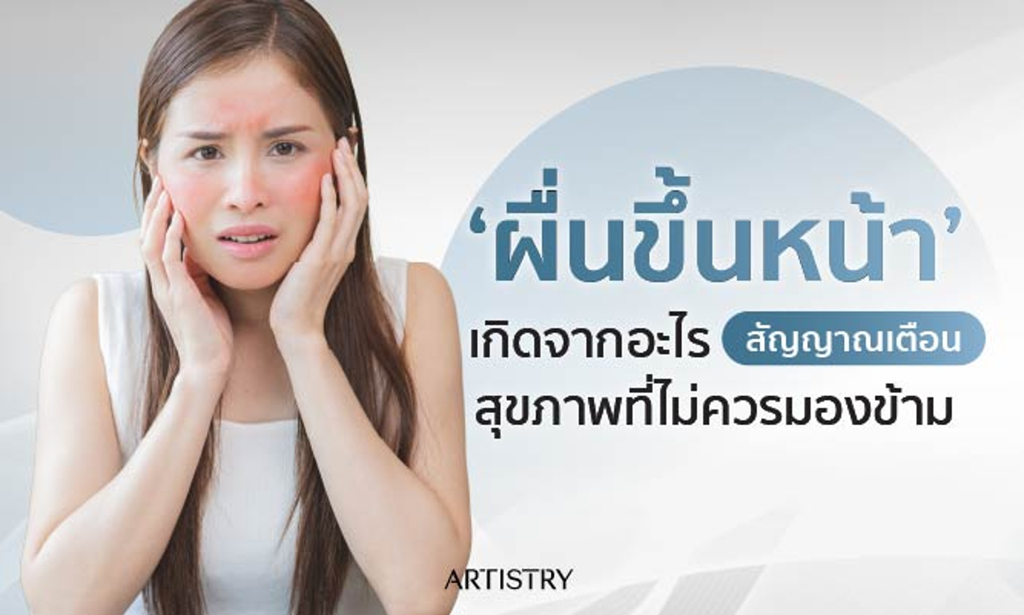 ผื่นขึ้นหน้า